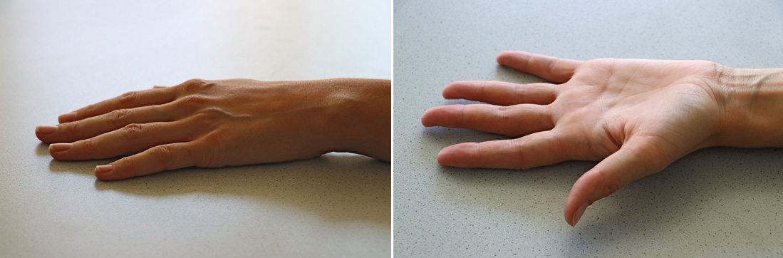 Referenzbilder zeigen Hände ohne Schmuck oder Nagellack, die als ideal gekennzeichnet sind.